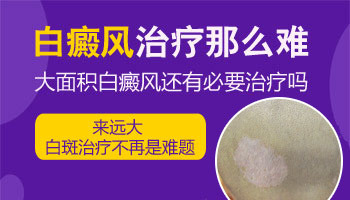 一岁半宝宝脸上有白斑