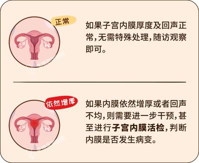 内膜增厚怎么治疗好