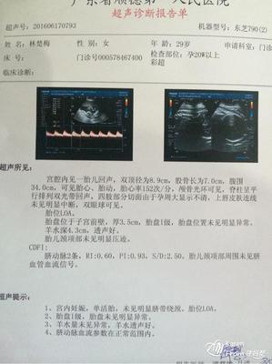 37周胎儿发育标准