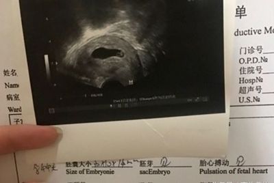 怀孕4个月能做流产吗