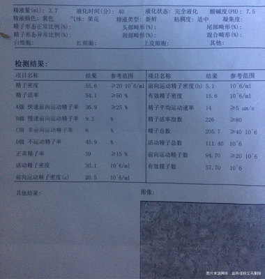 精子量多少多正常值