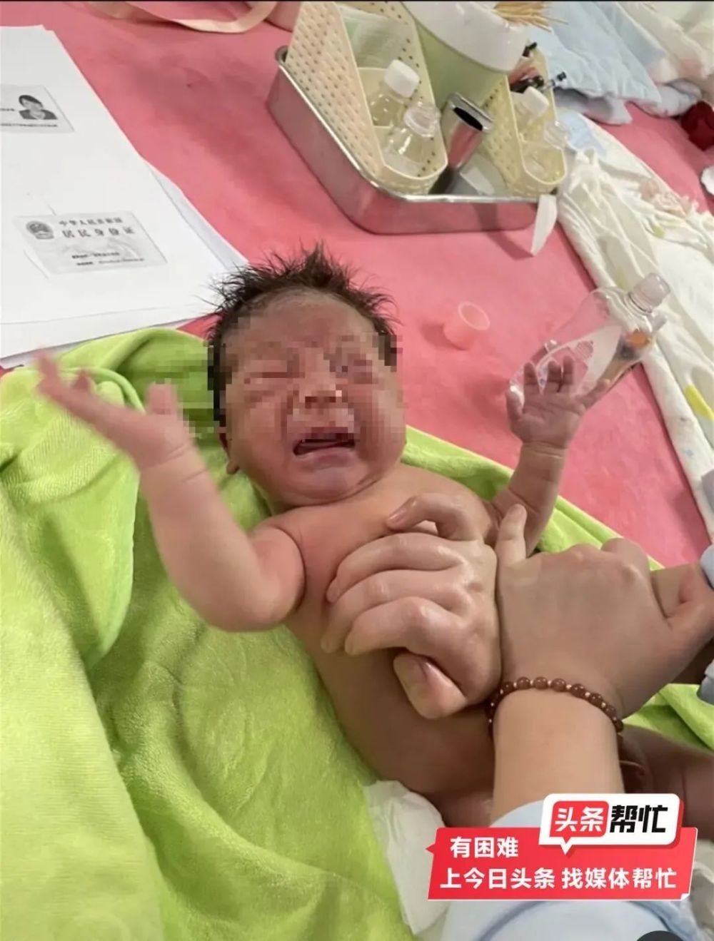 新生儿身上发青是怎么回事