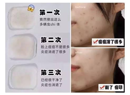 用洗面奶脸上干燥起皮