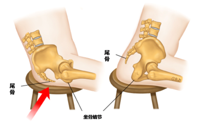 尾巴骨大是怎么回事啊