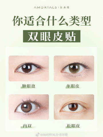 单眼皮肿眼泡怎么贴双眼皮
