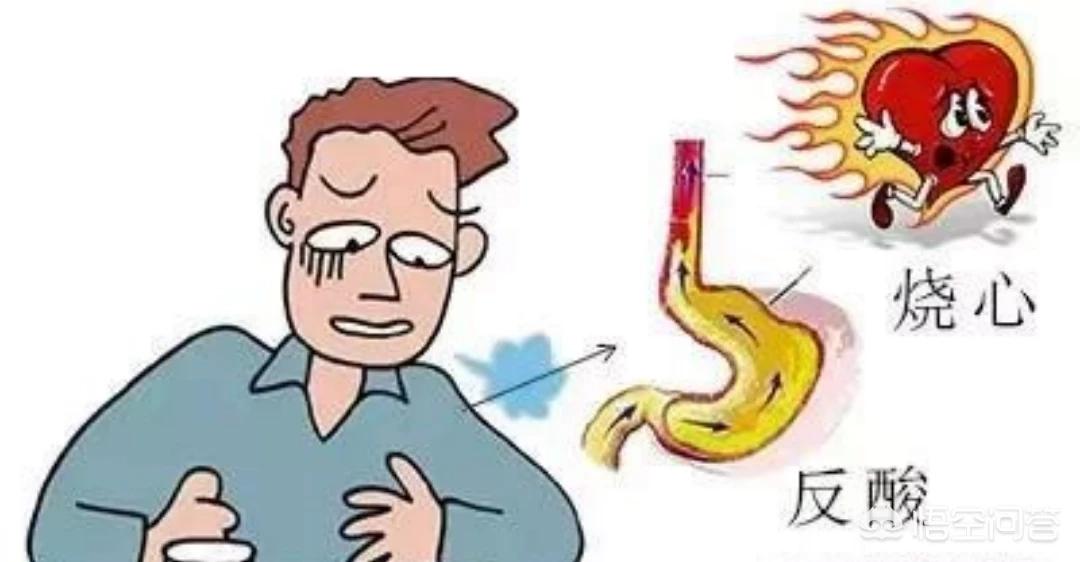 胃总感觉烧心是怎么回事