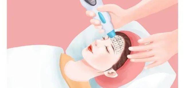 脸部激光脱毛费用