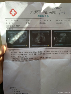 怀孕四十天彩超图片