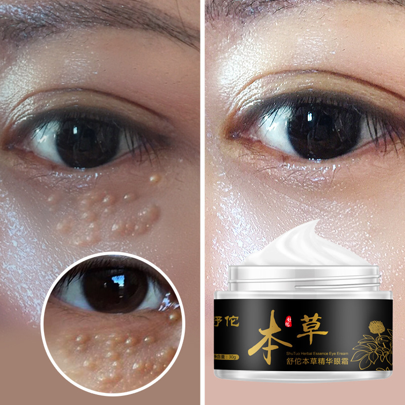 什么牌子眼霜去黑眼圈眼袋效果好