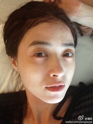 脸上有痘痘怎么掩盖