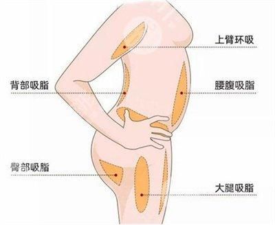 抽脂的危害