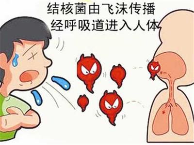 痰中带少量血丝是怎么回事