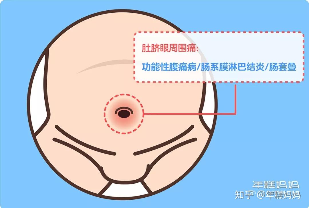 小孩肚脐眼疼是怎么回事