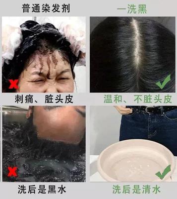 染发膏弄到头皮怎么洗