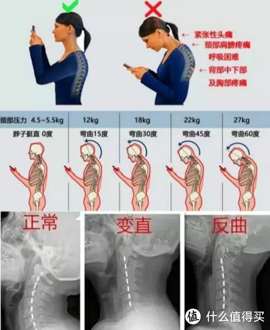 坐一会背疼是怎么回事