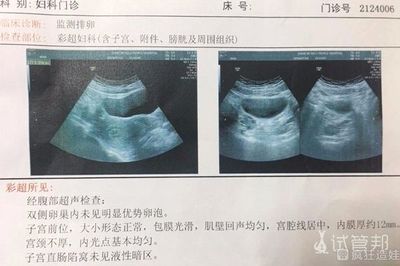 卵泡一个月有几个