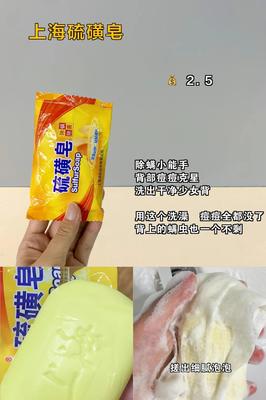 硫磺皂洗背痘痘会越多