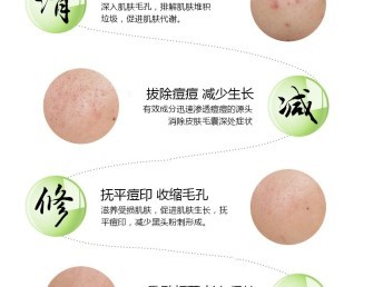 衡阳 痘痘