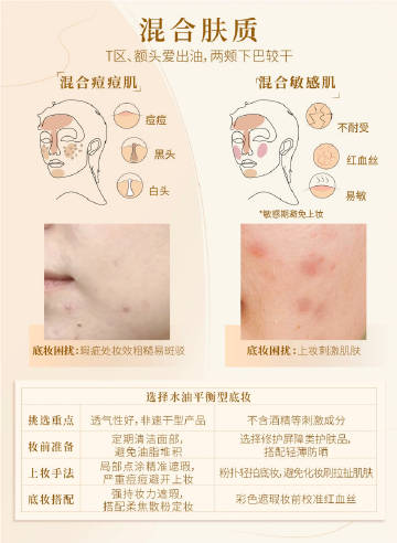敏感肌痘痘肌