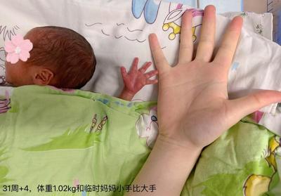 新生儿肠道出血