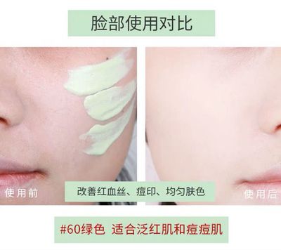 适合痘痘肌的防晒隔离