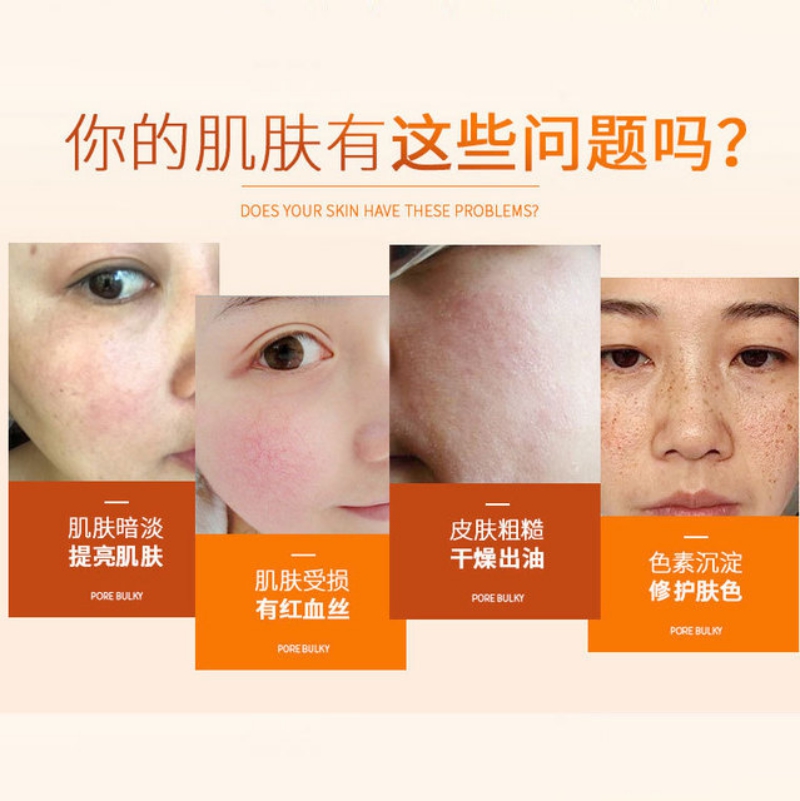 红血丝皮肤用什么面膜