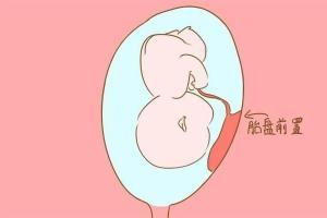 梦见自己生孩子出血