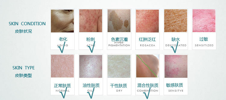 用什么牌子去痘痘