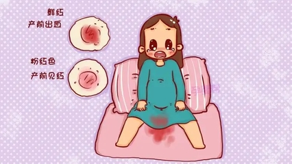 临产出血是怎么回事