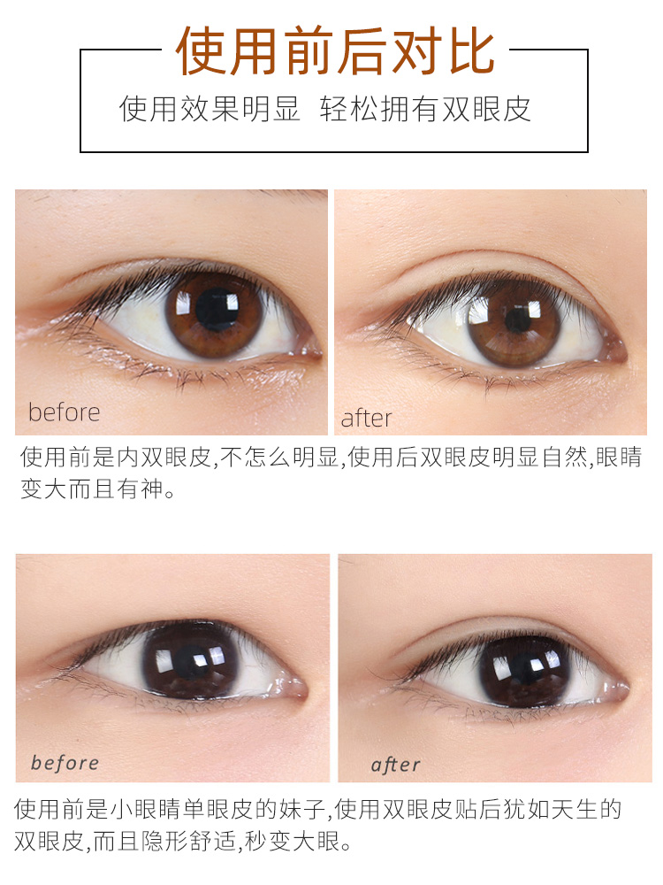 宽双眼皮贴