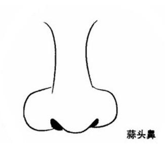 圆头鼻子的女人的面相