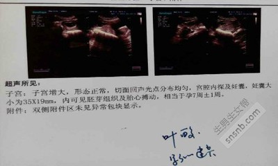 取环多久可以怀孕