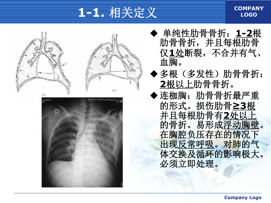 肋骨骨折需要怎么治疗