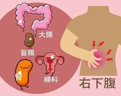 排卵期左下腹痛