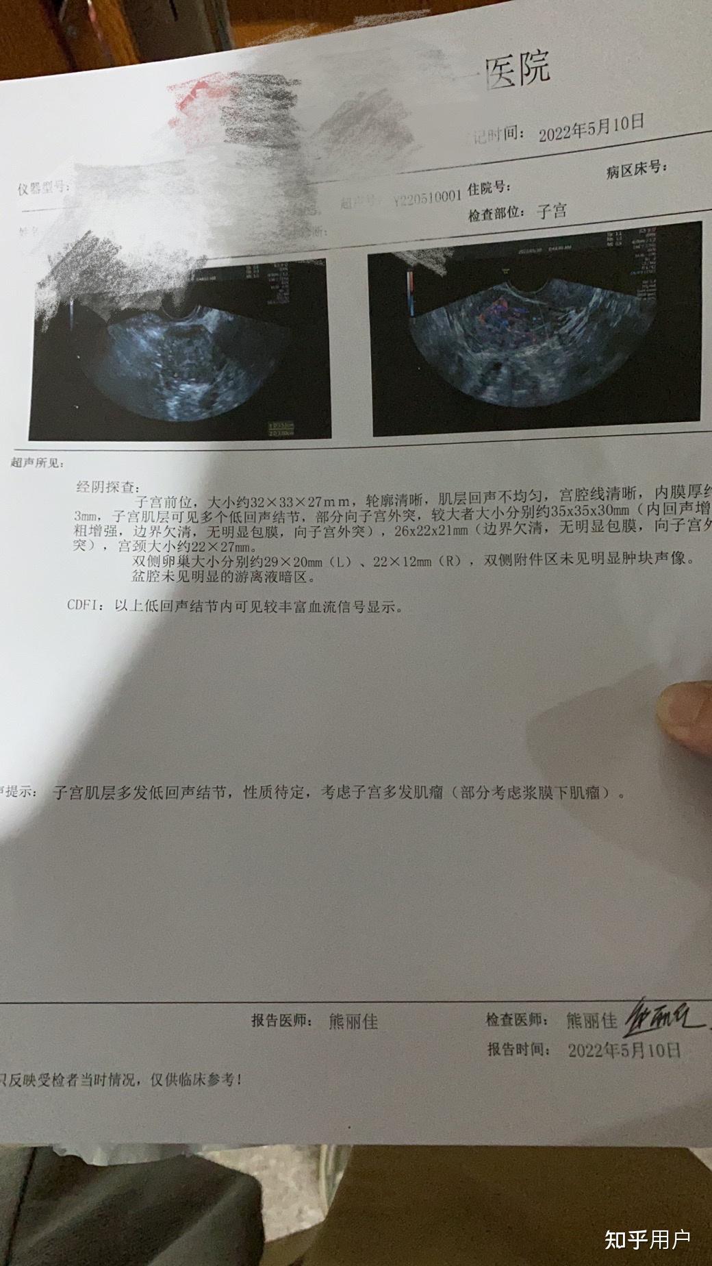 宫腔粘连怀孕怎么办