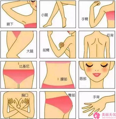 手背疤痕怎么去除