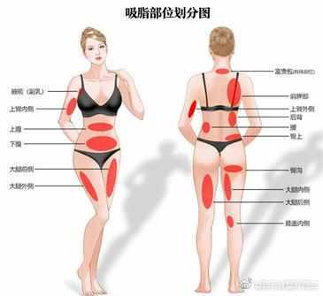 抽脂瘦身大概费用