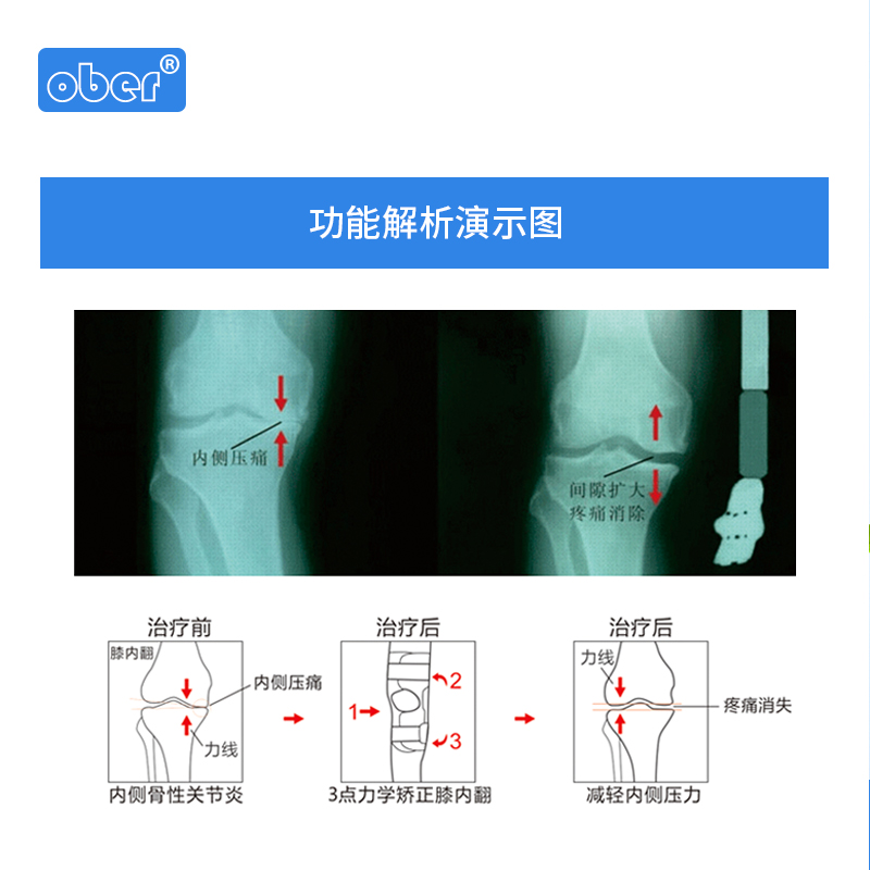 关节部位黑是怎么回事