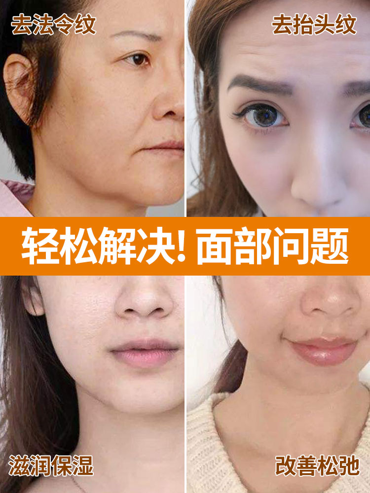 去 法令纹