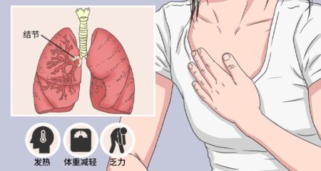 肺结节是怎么回事