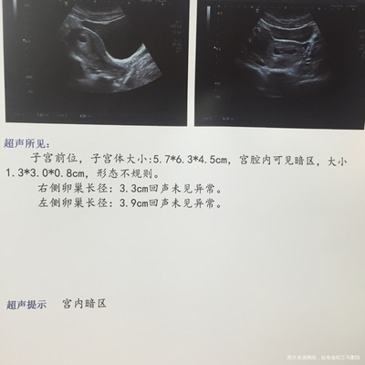 孕囊33*23怀孕多少天