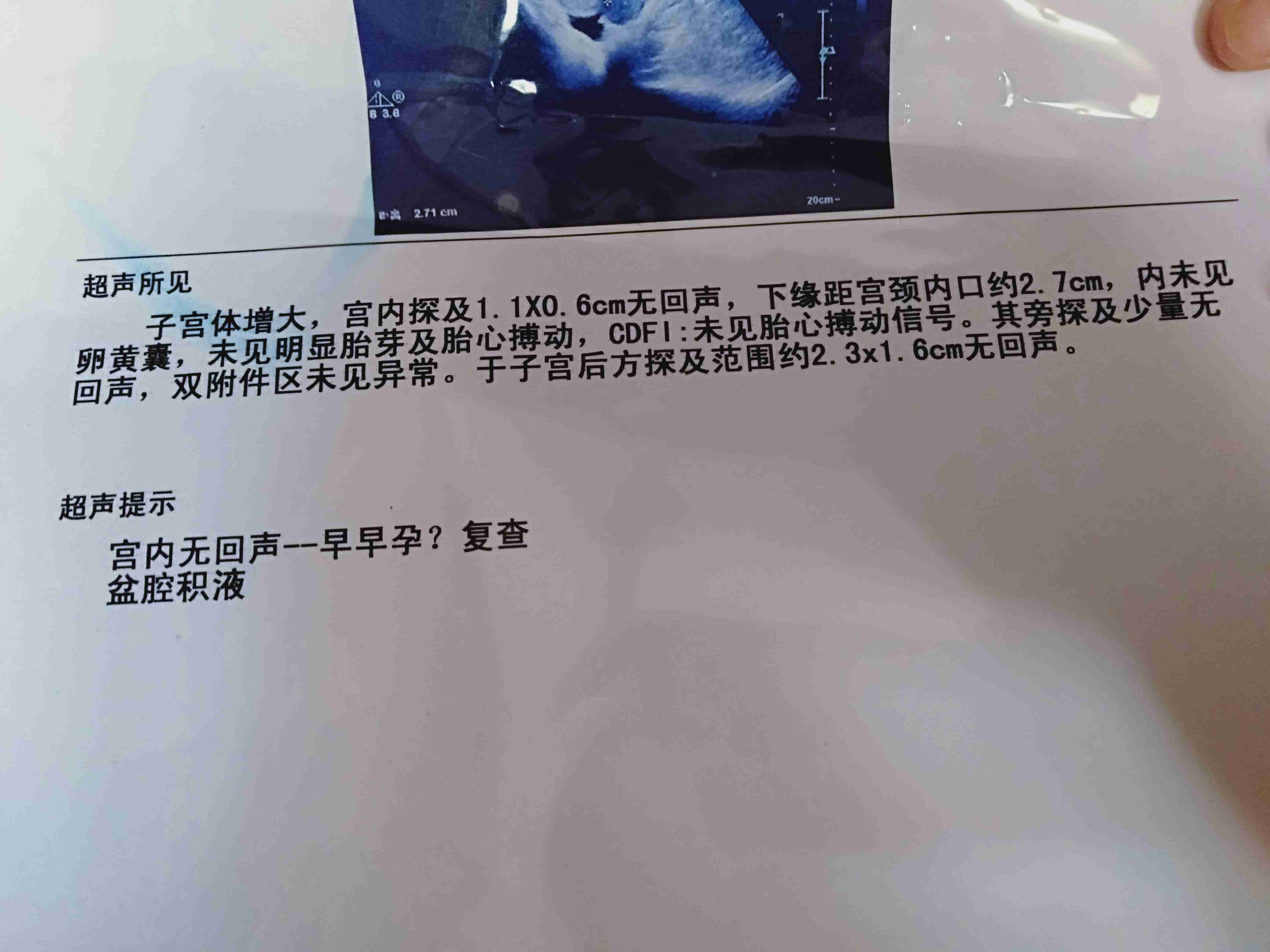 怀孕能用青霉素吗