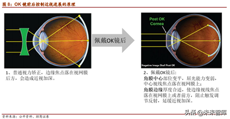 ok矫正镜片价格是多少