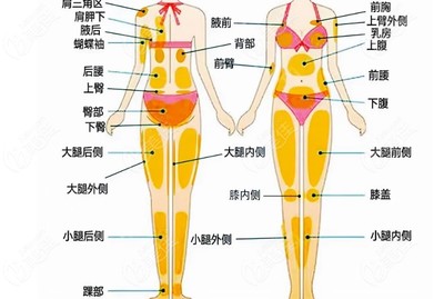 大腿抽脂大概多少费用