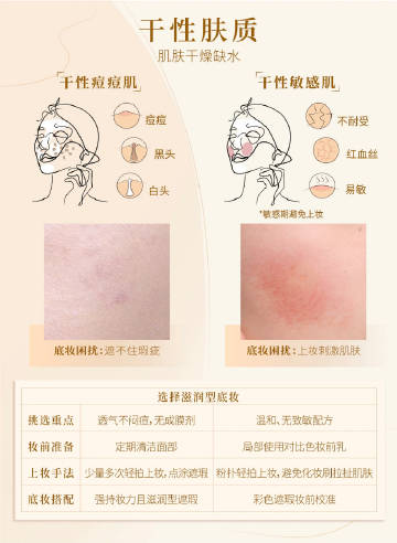 敏感肌痘痘肌