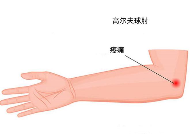 手腕内侧疼是怎么回事