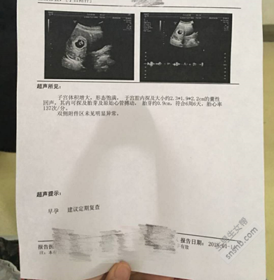 双侧卵巢多囊会怀孕吗