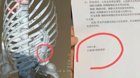 咳嗽挂内科还是呼吸科