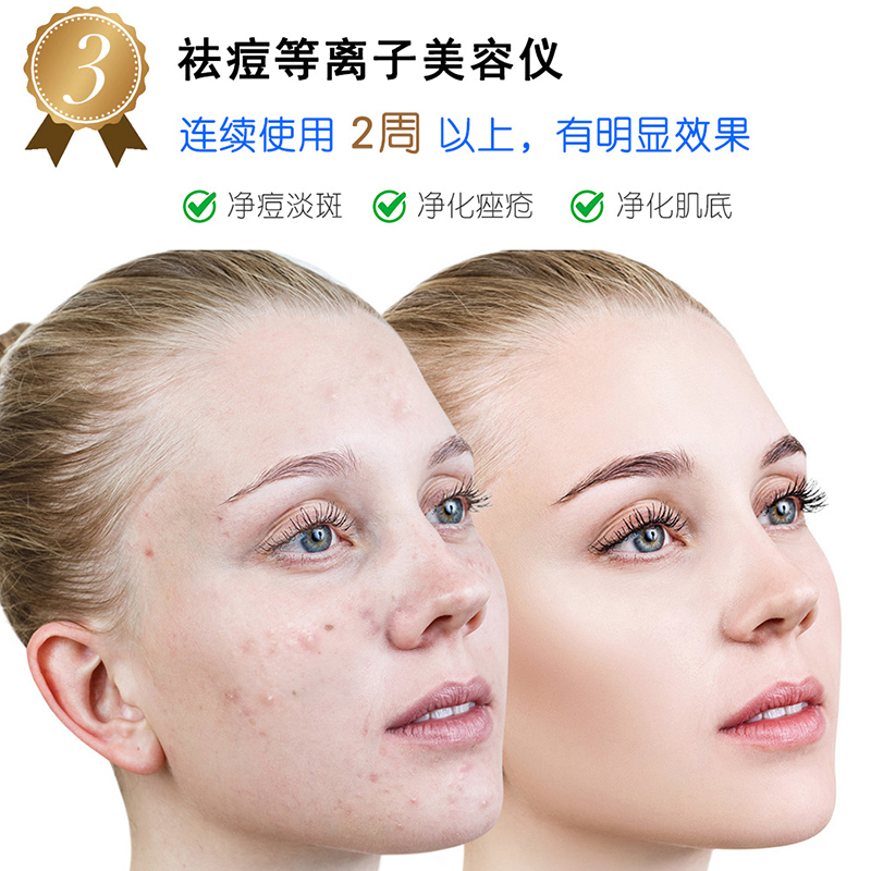 脸上的痘痘有什么分类