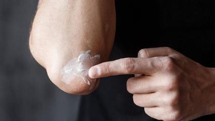 烫伤9个月仍然有黑色素